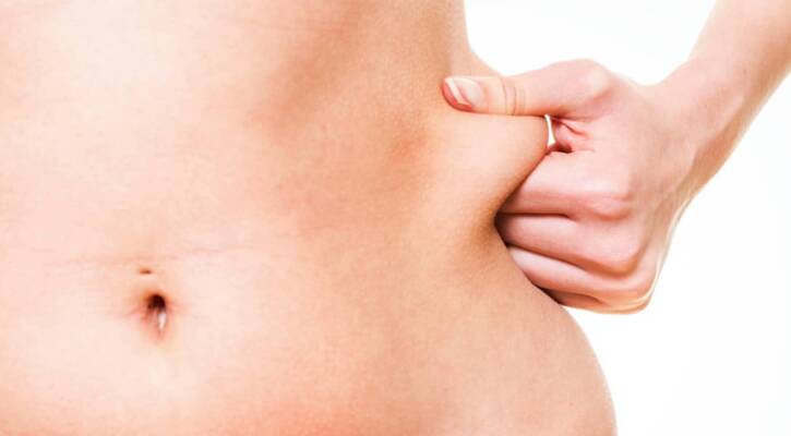 Comment me débarrasser de mes poignées d’amour sans chirurgie ? | Centre Laserio | Paris 8